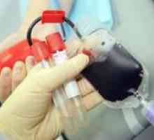 Jak darovat krev?