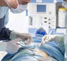 Jak je odstranění dělohy laparoskopicky?