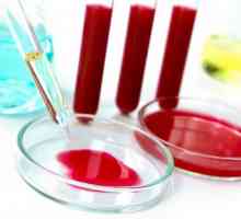 Jak se krevní test pro Giardia