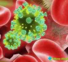 Jak získat infekci HIV: vše, co potřebujete vědět o viru
