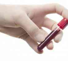 Co by mělo být normou bílých krvinek u zdravého člověka?