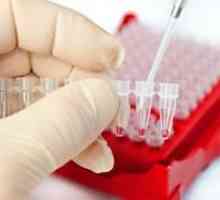 Jaké testy krve jsou řešeny hypotyreózy a jaké nemoci mohou detekovat?