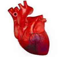 Jaké mohou být důsledky rozsáhlého infarktu myokardu?