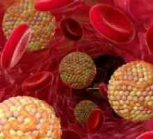 Jaká je míra cholesterolu v krvi, a nebezpečí překročení jejího