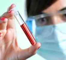 Jaká je míra bilirubinu v krvi dětí, žen a mužů? Biochemická analýza krve.