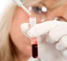 Jaká je míra ESR v krvi žen? Klíčové ukazatele.