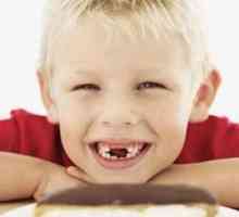Zubní kaz a jeho příčiny