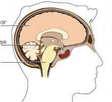 Cysta epifýza (epifýza) mozek