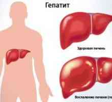 Hepatitida Clinic na: akutních a chronických forem