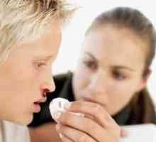 Krvácení z nosu - zjistit příčinu a učit se rychle zastavit