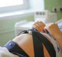 CTG plod během těhotenství (kardiotokografie)