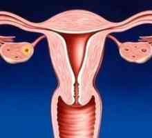 Léčba cervicitida lidových prostředků