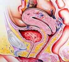 Léčba endometriózy lidových prostředků