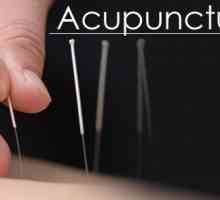 Léčba čínské akupunktury
