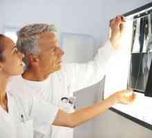 Léčba osteoartrózy kyčelního kloubu