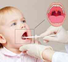 Léčba angíny u dětí