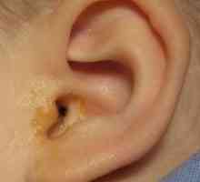 Léčba ušního exkrementy