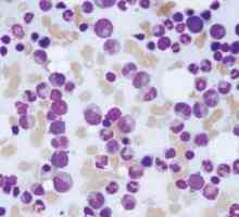 Leukocytóza, kdy a proč tam je, formy, klasifikace a funkce leukocytů