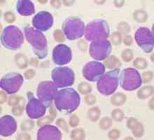 Lymfocytů v lidské krvi