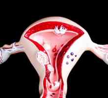 Děložní krvácení: 23 důvodů, proč volat tento proces