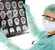 Meningiom Brain: Důsledky po operaci