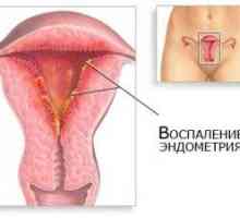 1 Měsíc při endometritidy