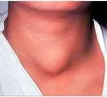Způsobům léčby s použitím thyroiditis lidových opravné
