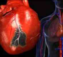 Zvýšení levé komory srdeční