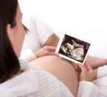 Mohu otěhotnět s endometriózou nebo po něm? Jak plánovat?
