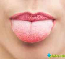 Plaque bílá jazyk: příčiny, léčba a prevence