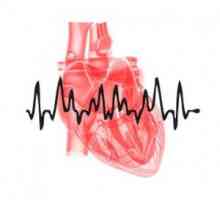 Srdeční arytmie: typy, příčiny, příznaky, léčba
