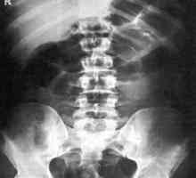 Neinvazivní metoda výzkumu - X-ray dutiny břišní