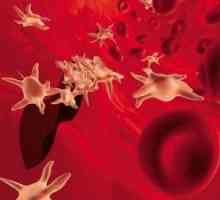 Nízké hladiny krevních destiček v krvi