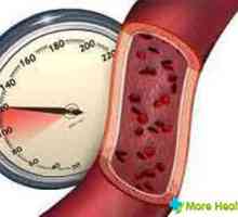 Co může svědčit pro snížení vysokého krevního tlaku?
