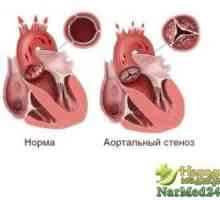 Zmírňuje příznaky aortální chlopně u dospělých a dětí