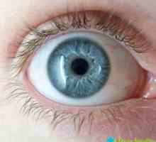 Nádorové očí: příznaky a jak se vyléčit nádor může být
