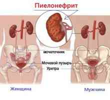 Koncepty ledvin pyelonephritis