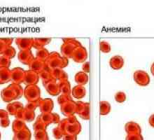 Mezi hlavní příčiny anémie