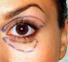 Vlastnosti transconjunctival blepharoplasty oko