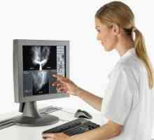 Papilom v prsních kanálků: příčiny, diagnostika, léčba