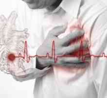 První příznaky srdečního infarktu u mužů. Příznaky onemocnění.