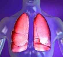 Pneumonie (zánět plic). Léčba lidových prostředků.