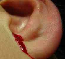 Proč je krvácení z ucha