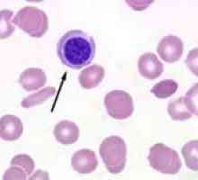 Proč snížené lymfocytů v krvi