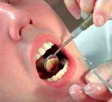 Vylezl jsem po zubních dásní: jak ji léčit?