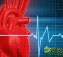 Pomáhat Lidové léky pro léčbu srdečního Artim