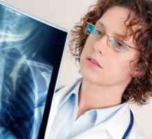Příznaky a léčba zápalu plic