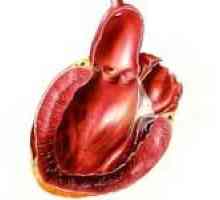 Hlavními příznaky infarktu myokardu