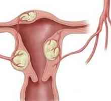 Gynekologická onemocnění během menopauzy