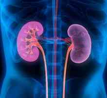 Příčiny a klinický obraz gidrokalikoza ledvinu